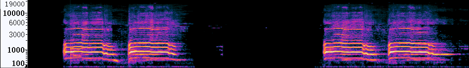 res11s1